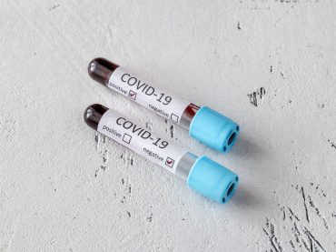 coronavirus-testing-ET8N9RX.jpg